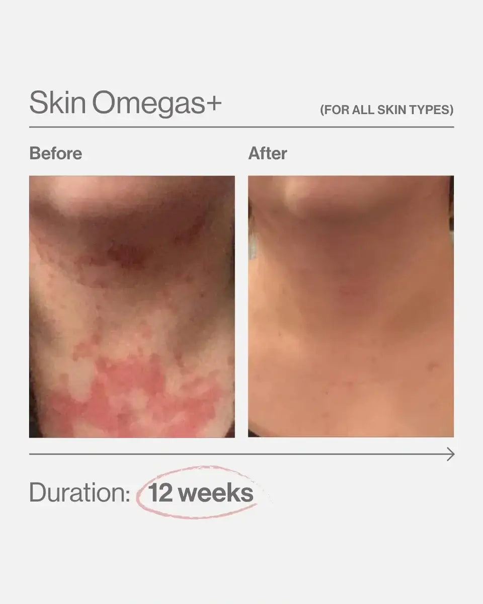Skin Omegas+ Advanced Nutrition Programme 60 caps
