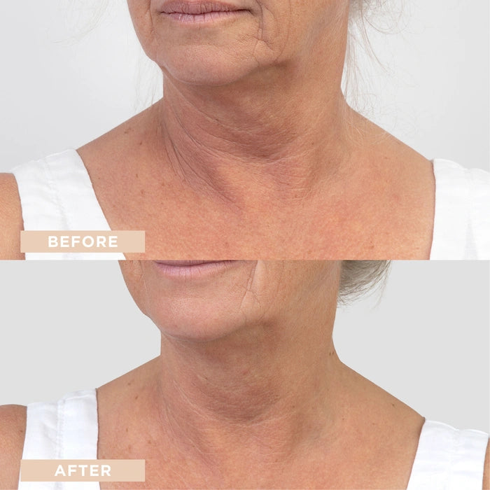 LYCON Skin Revitalising Hyaluronic + B5 Booster Serum 30ml
