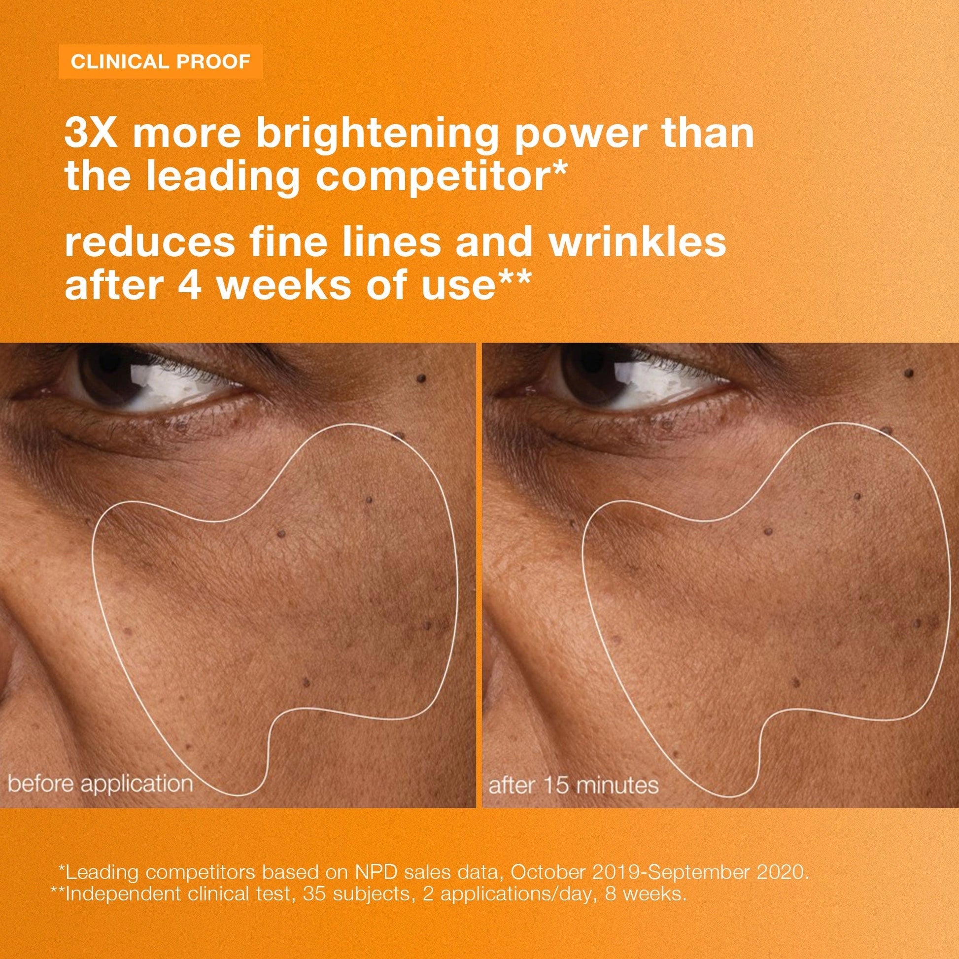 Dermalogica BioLumin-C Gel Moisturizer 50ml voor helderdere huid, vergelijken voor en na gebruik van 15 minuten.