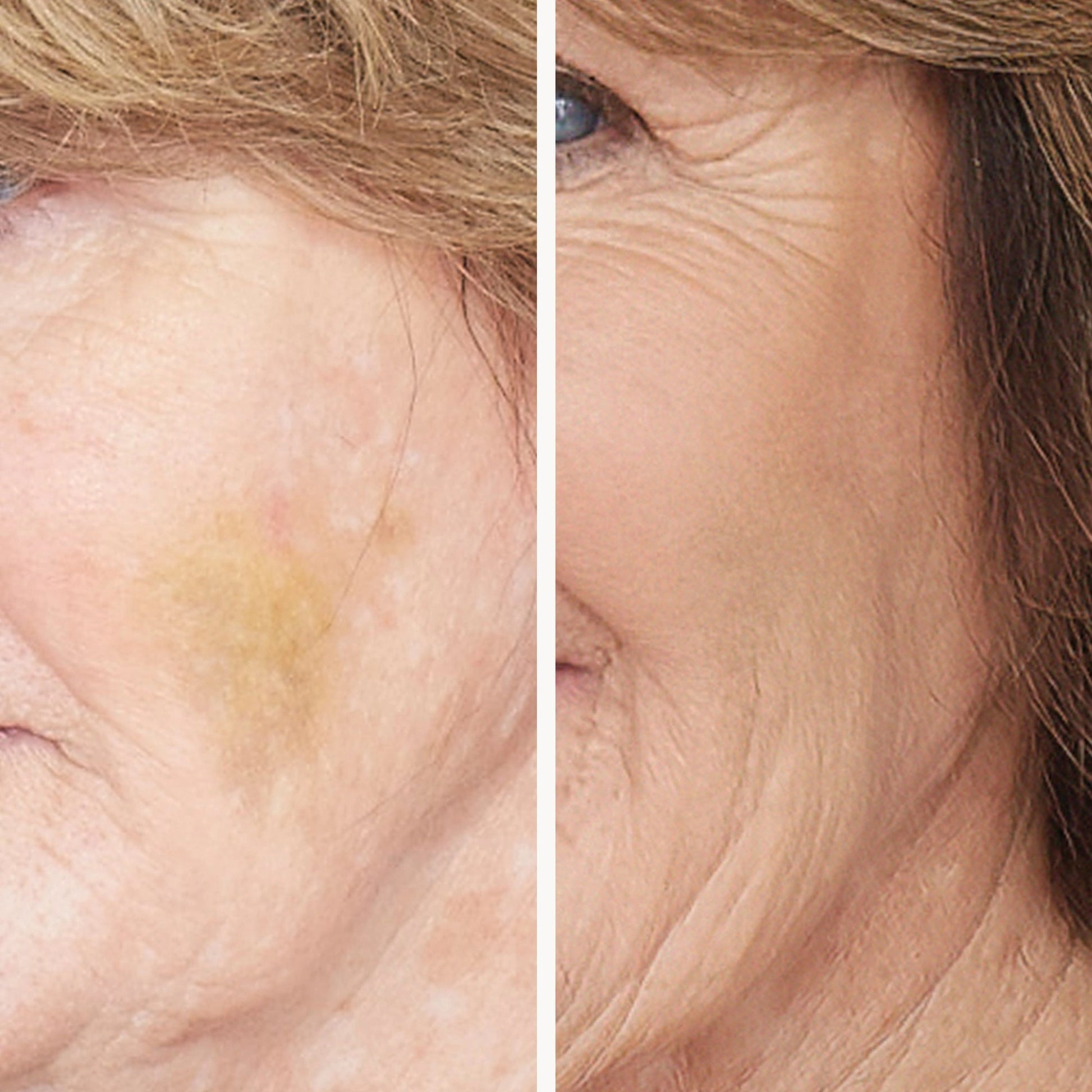 Jane Iredale Corrective Colors 9,9g voor het camoufleren van hyperpigmentatie en blauwe plekken, voor en na toepassing.