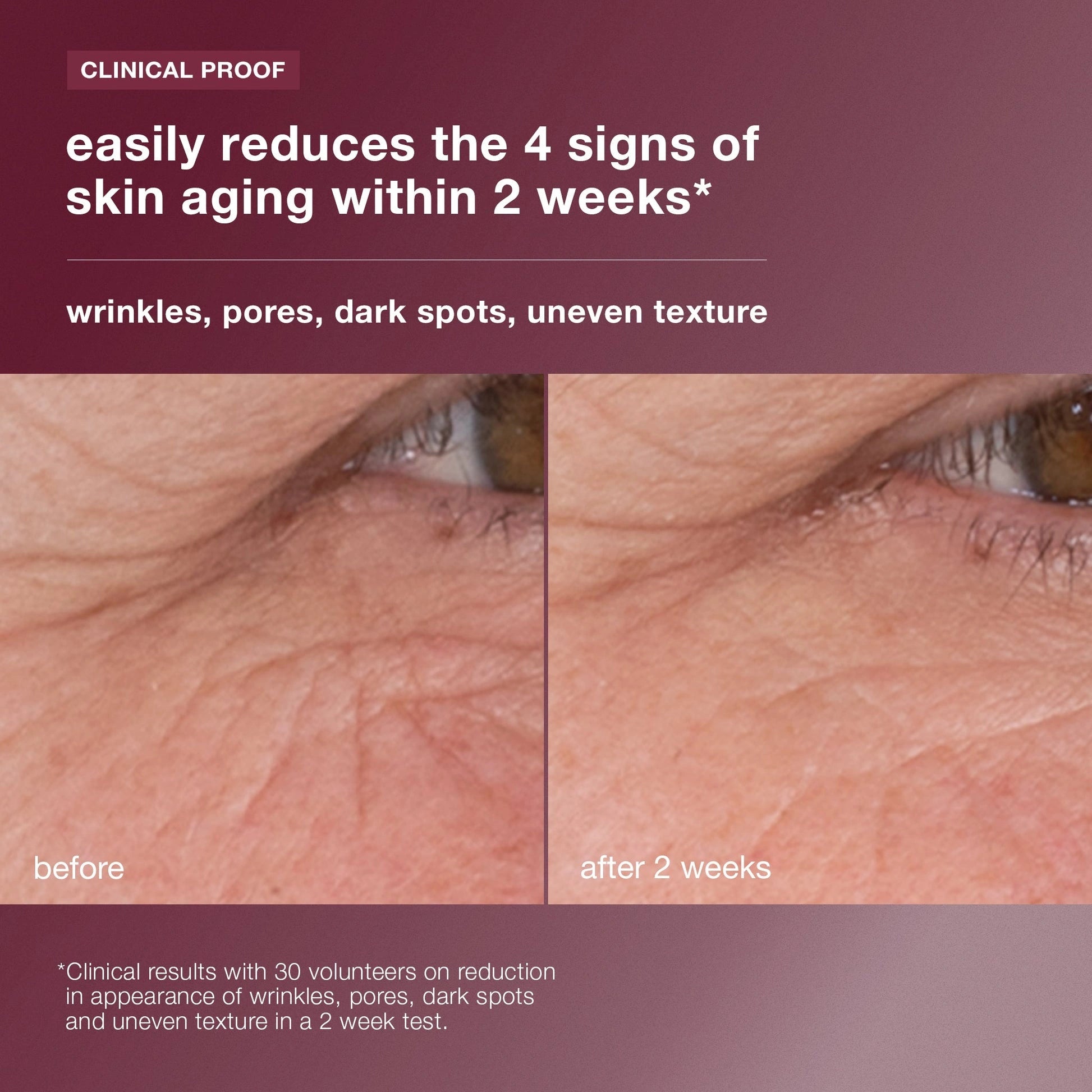 Dermalogica Dynamic Skin Retinol Serum 30ml voor rimpels en huidveroudering, voor en na effecten na 2 weken gebruik.