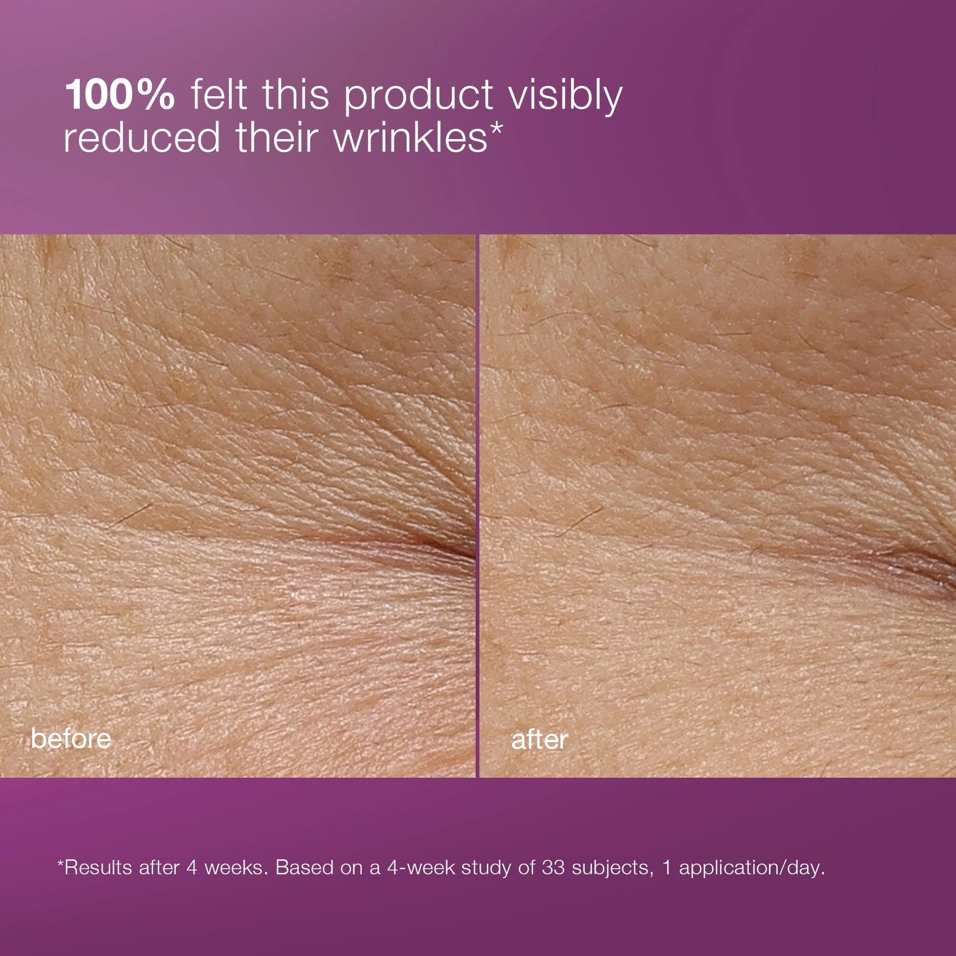Dermalogica MultiVitamin Power Recovery Cream 50ml voor en na resultaat, zichtbaar verminderen van rimpels op de huid na 4 weken gebruik.
