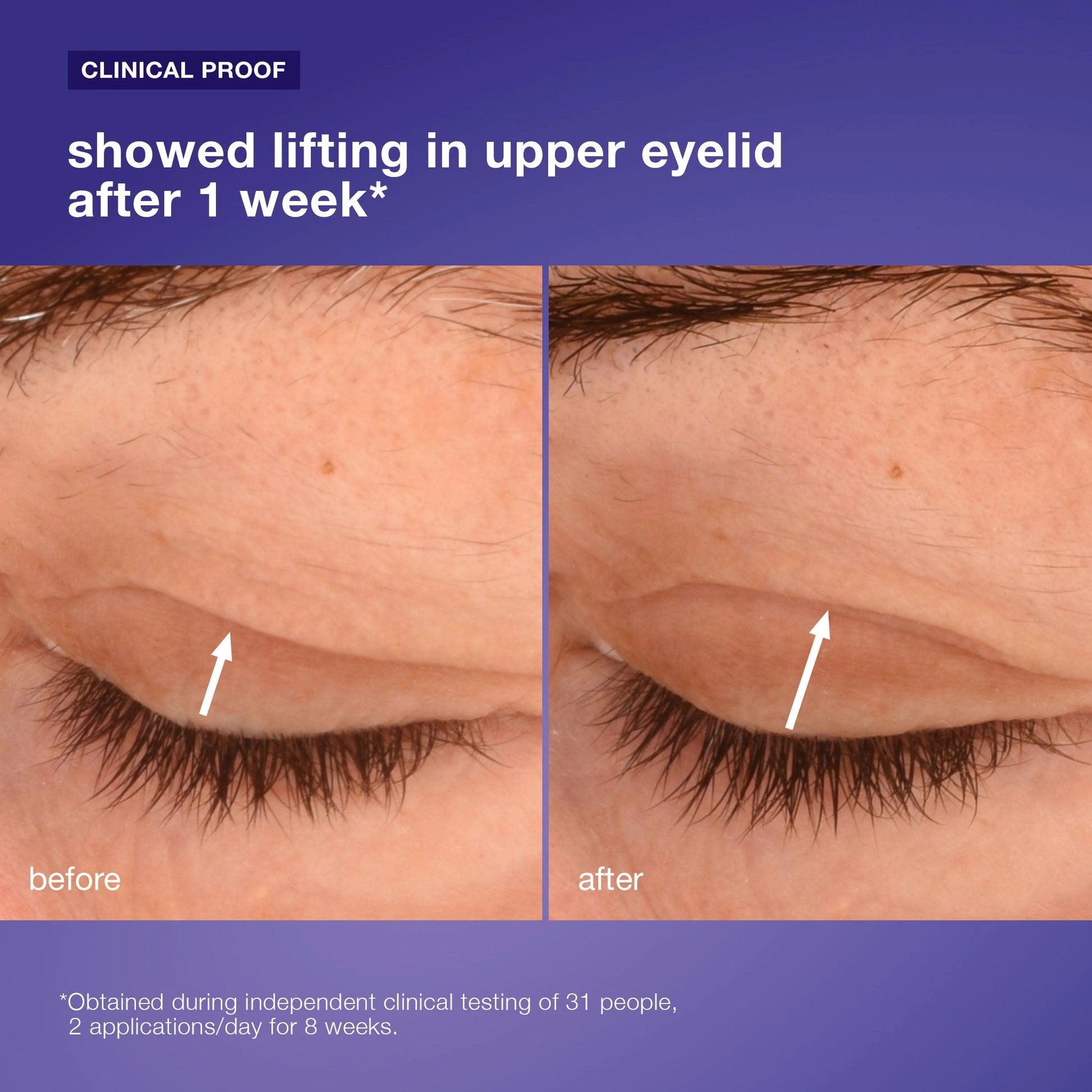 Dermalogica Phyto Nature Lifting Eye Cream 15ml toepassing, klinisch bewijs van lifting in het ooglid na 1 week.
