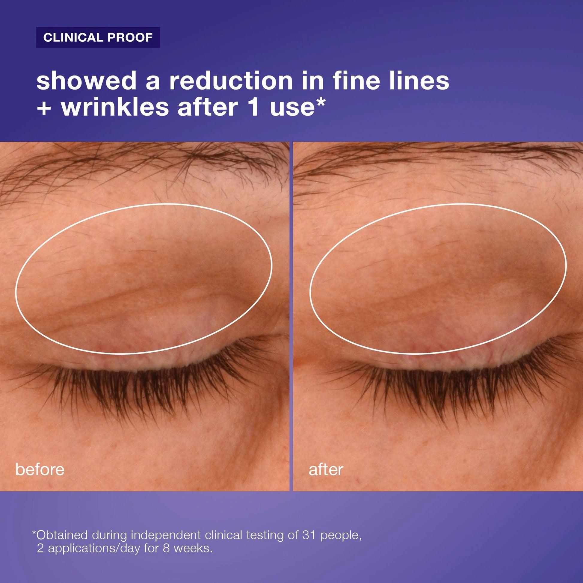 Dermalogica Phyto Nature Lifting Eye Cream 15ml voor en na resultaten met zichtbare vermindering van fijne lijntjes en rimpels