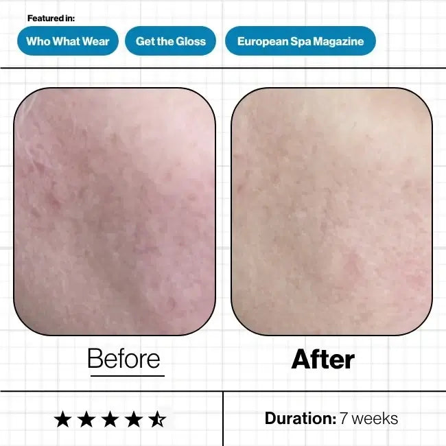 Skin Moisture IQ Advanced Nutrition Programme 28x 5 caps