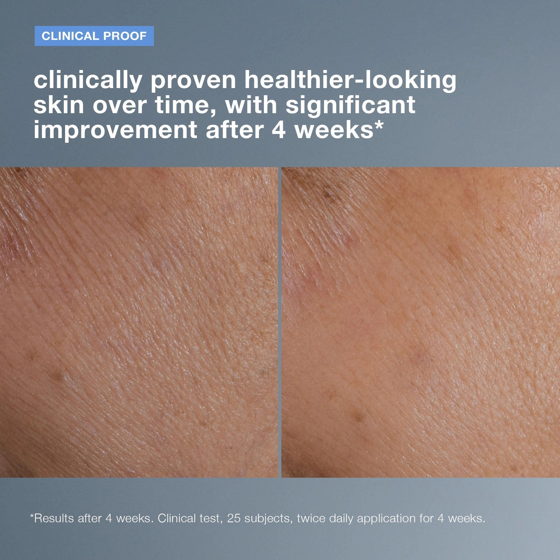 Dermalogica Smart Response Serum 59ml klinisch bewezen huidverbetering na 4 weken gebruik, zichtbaar resultaat op de huid.