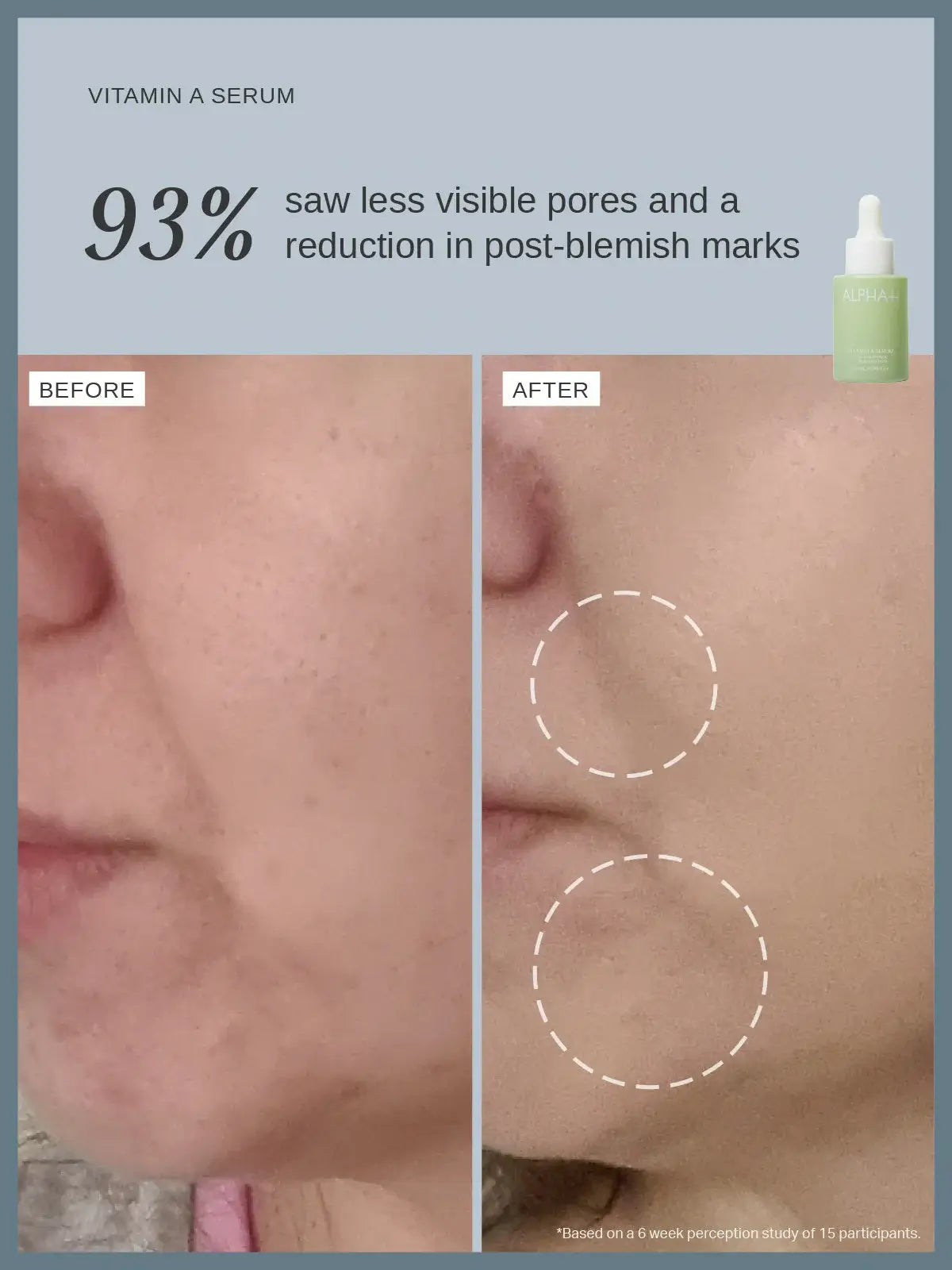 Alpha-H Vitamin A Serum with 0.5% Retinol 25ml