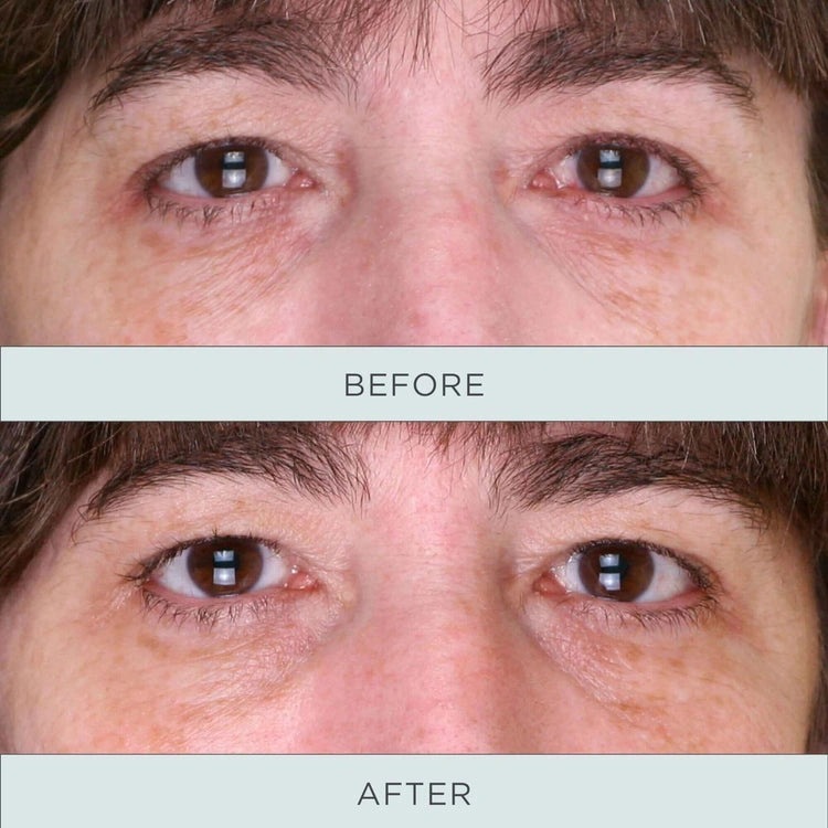 PUR Tone Up Niacinamide Firming Eye Serum 12,5ml